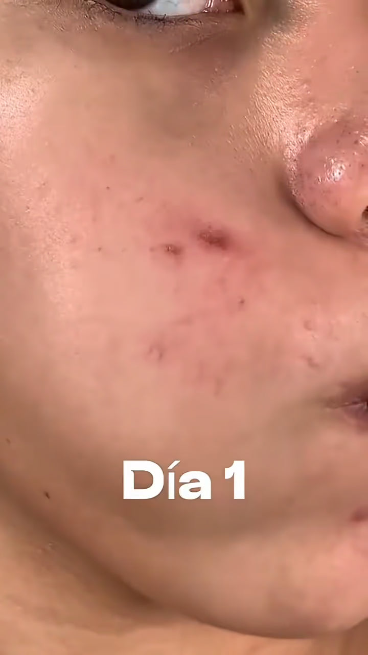 Testimonio de clienta