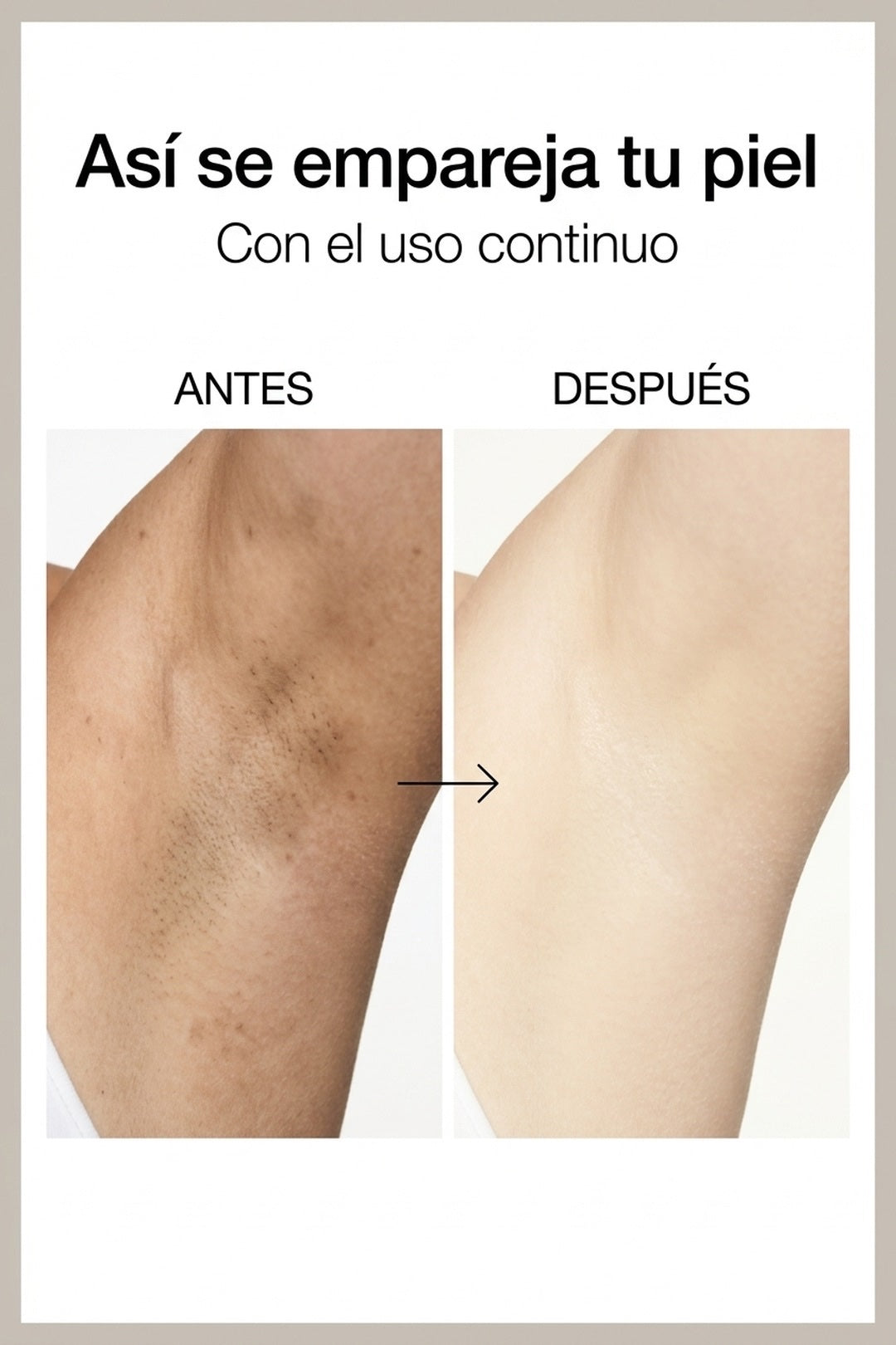 Antes y después: piel más pareja con el uso continuo