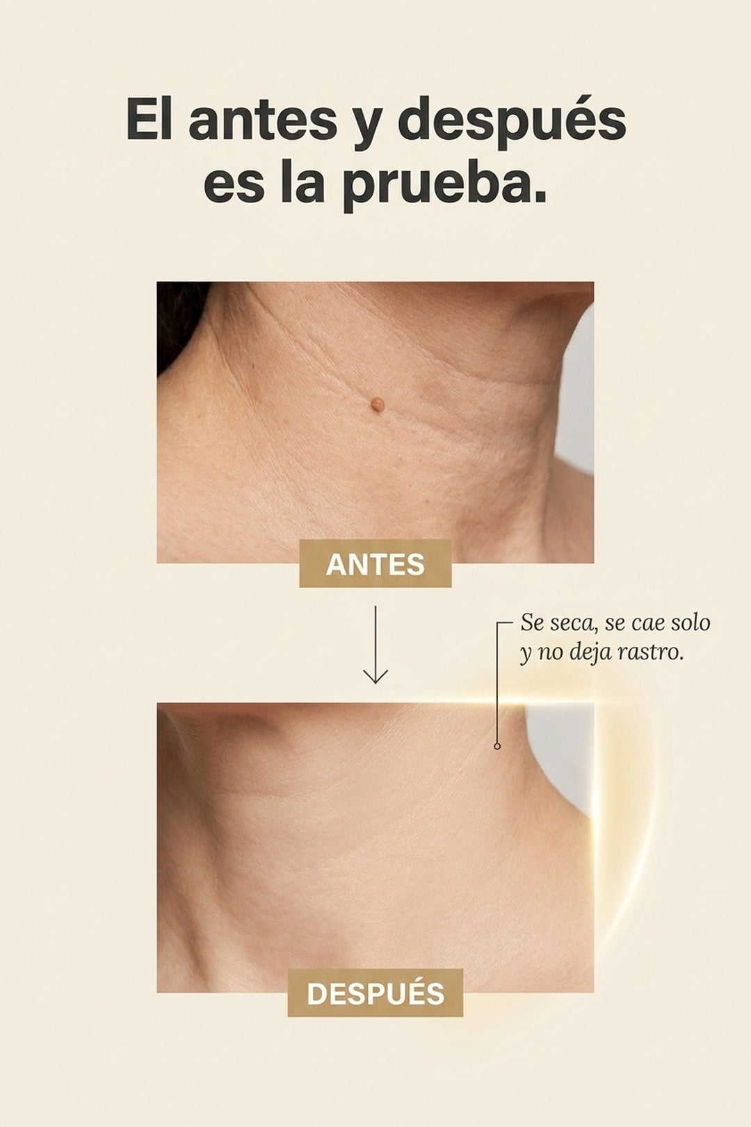 Antes y después: de la imperfección a la piel lisa