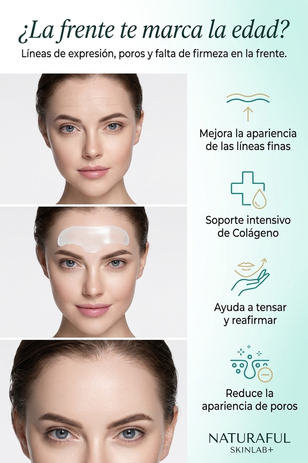 ¿La frente te marca la edad? Líneas de expresión y falta de firmeza
