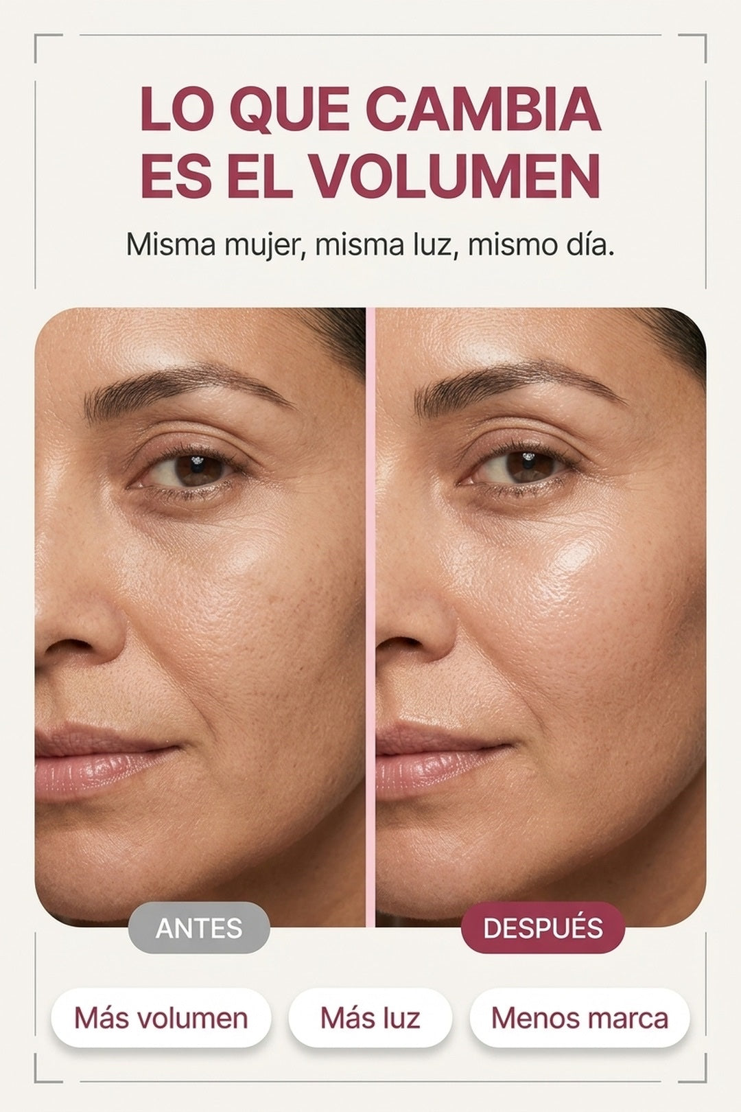 La misma piel, con el volumen recuperado
