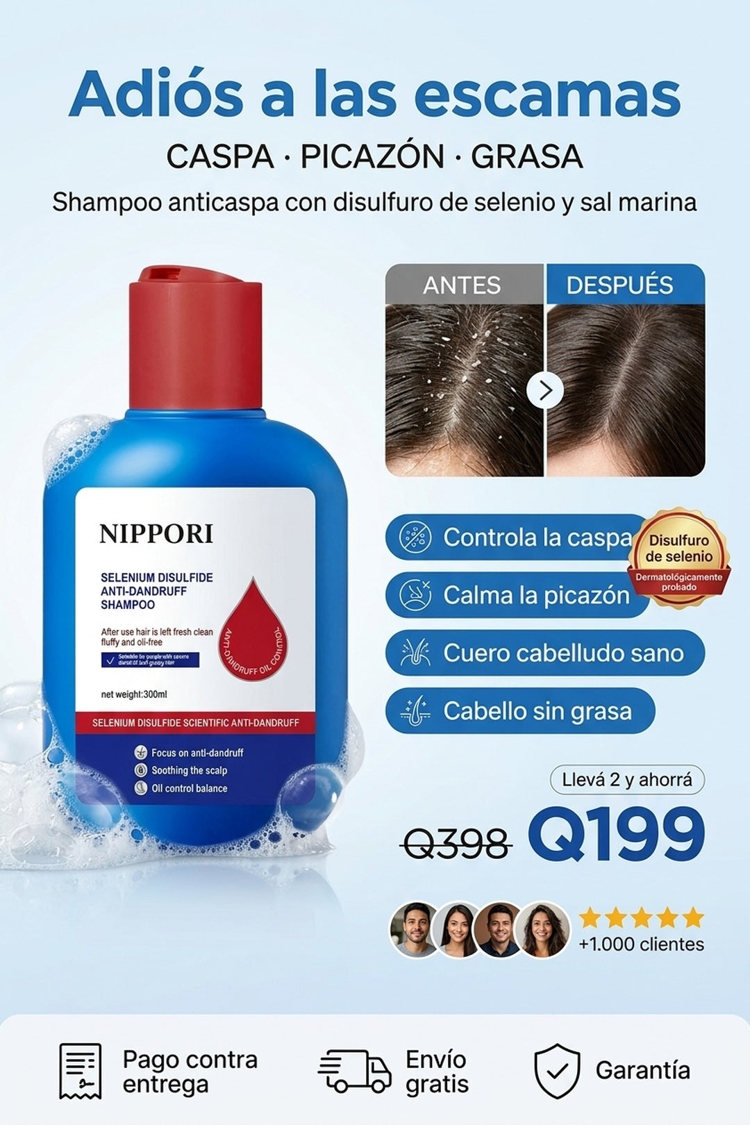 NIPPORI shampoo anticaspa con disulfuro de selenio, adios a las escamas